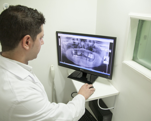 Doctor looking at a digital X-ray