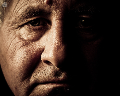 Man with liver cancer looking at the camera with a serious expression