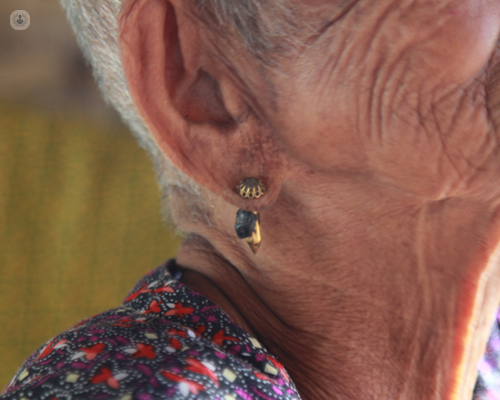 Close up side shot of older lady wearing earring in possible partially-split earlobes