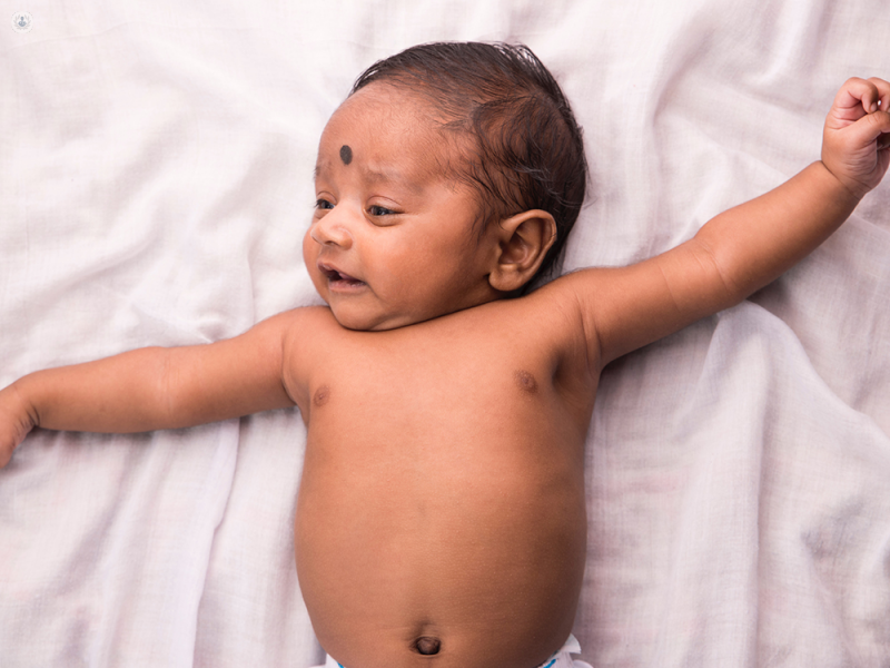 Umbilical hernias: does my child need surgery?