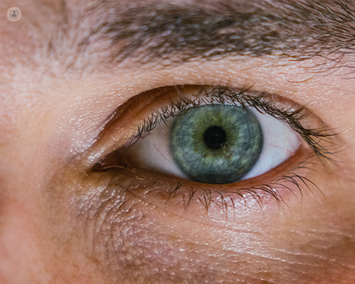 Close up of a man's eye, who might need ophthalmic brachytherapy