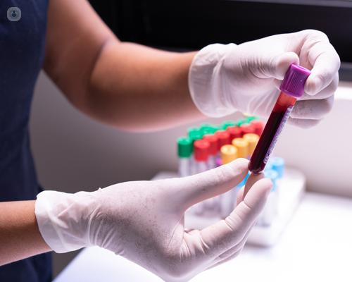 A blood test is used to analyse mycophenolate levels