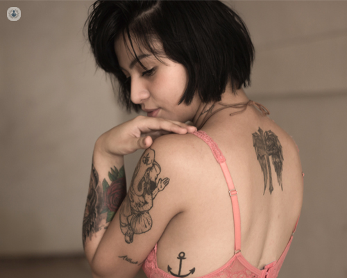 A woman with a tattoo on her upper body. Laser tattoo removal can remove unwanted tattoos.