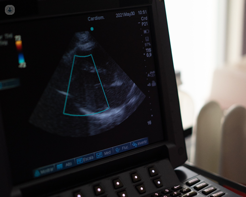 Cardiology ultrasound used in TOE testing