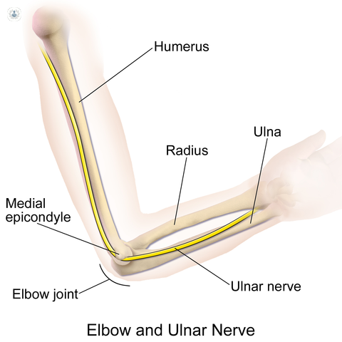 What is ulnar nerve surgery?