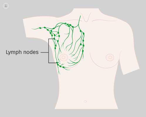 Diagram of the lymph nodes which can become clogged and cause lymphoedema