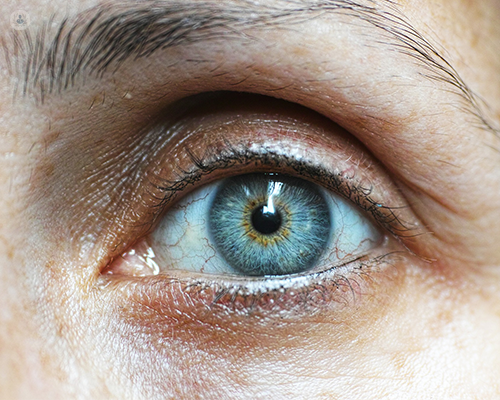 A close up of a blue eye. With untreated glaucoma, a patient can go blind. However, this condition is easily treated once discovered.